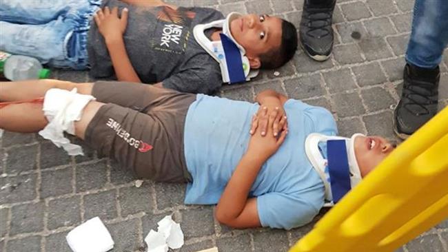 Injured Palestinian children receive medical treatment after being run over by an Israeli settler in East Jerusalem al-Quds on August 10, 2017.
