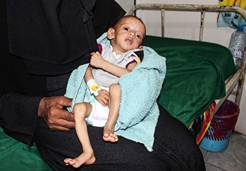7,500 Kids Killed or Wounded in Yemen Since 2013
