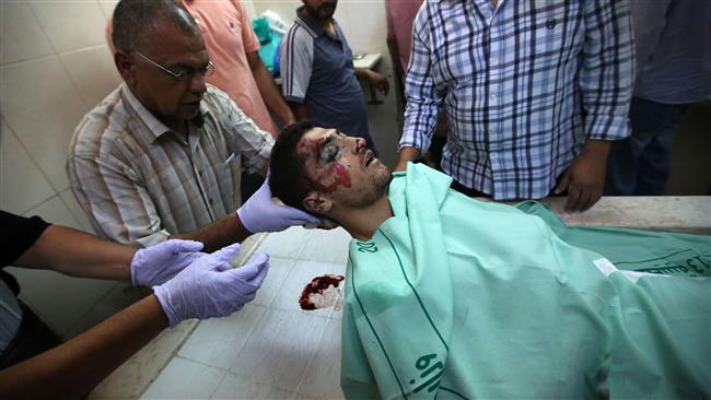 Injured Palestinian Young Man