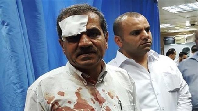 This picture, provided by Ma’an news agency, shows an injured Palestinian man at Rafidiya Hospital in Nablus, occupied West Bank, following clashes at the Palestinian village of Qusra, September 12, 2016.