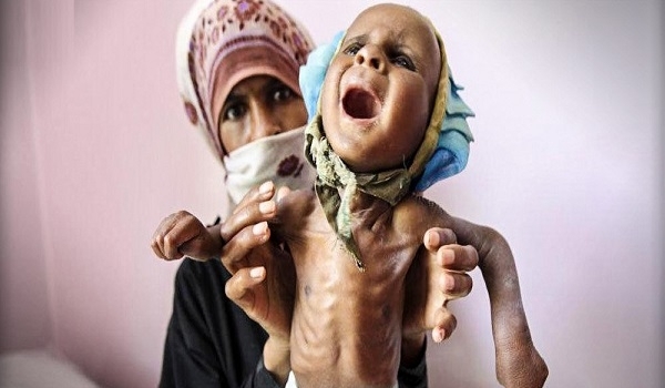 Famine in Yemen