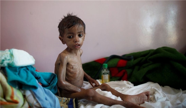 Yemen Famine