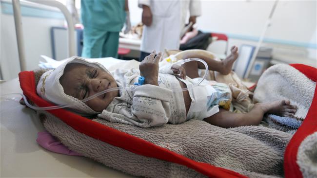 A Yemeni child suspected of being infected with cholera receives treatment at a hospital in Sana’a, the capital city of Yemen, on May 25, 2017. (Photo by AFP)
