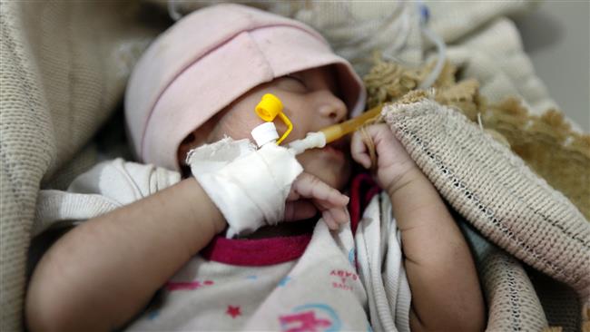 A Yemeni infant suspected of being infected with cholera receives treatment at a hospital in Sana