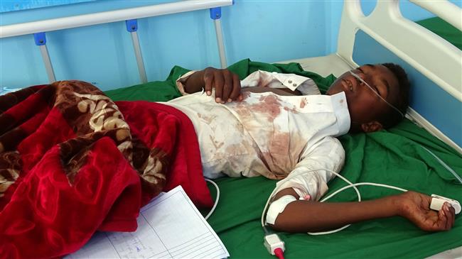 A Yemeni boy, injured in an air raid on a wedding party in Yemen, receive treatment at a hospital in Yemen