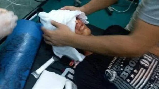 Fifteen-year-old Palestinian Muaman Abu Eyada is seen at a hospital in Rafah in the besieged Gaza Strip on September 19, 2018, after he was shot in the head by Israeli soldiers a few hours earlier.
