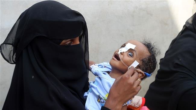 A Yemeni woman carries a malnourished child as she waits during food distribution in the province of al-Hudaydah in western Yemen, May 30, 2018. (Photo by AFP)
