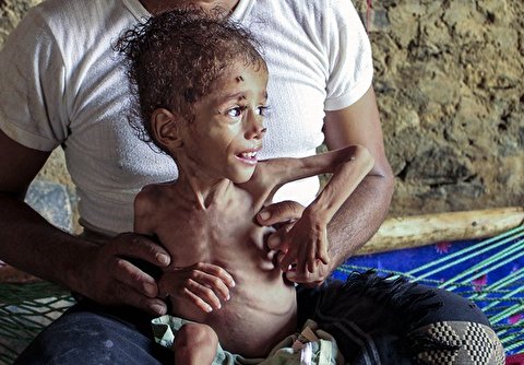 Help Children in Yemen