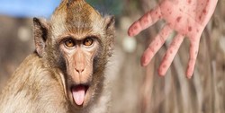 رعایت شیوه نامه‌های بهداشت فردی و جمعی برای پیشگیری از ابتلا به ویروس میمون
