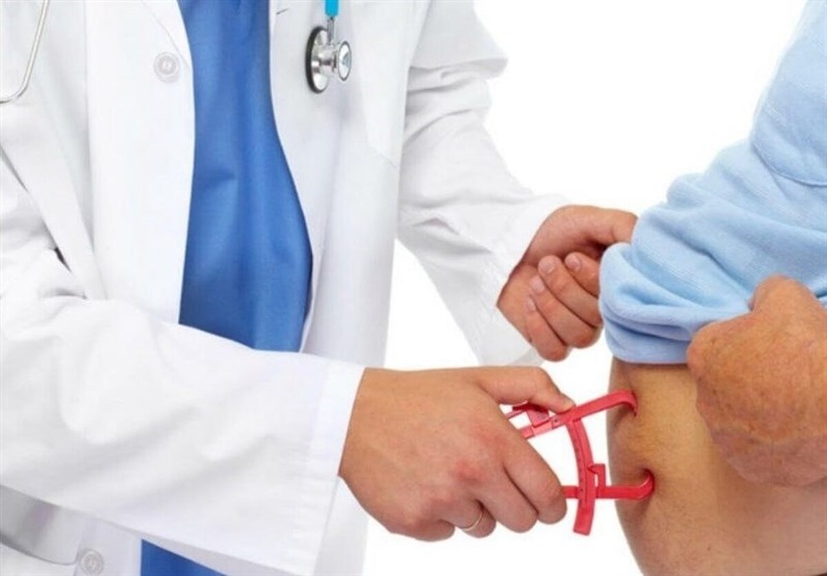 ۱۶ میلیون ایرانی اضافه وزن دارند