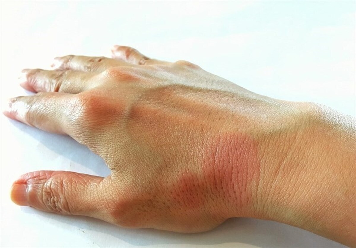 کشف جدید دانشمندان درباره علت بیماری 